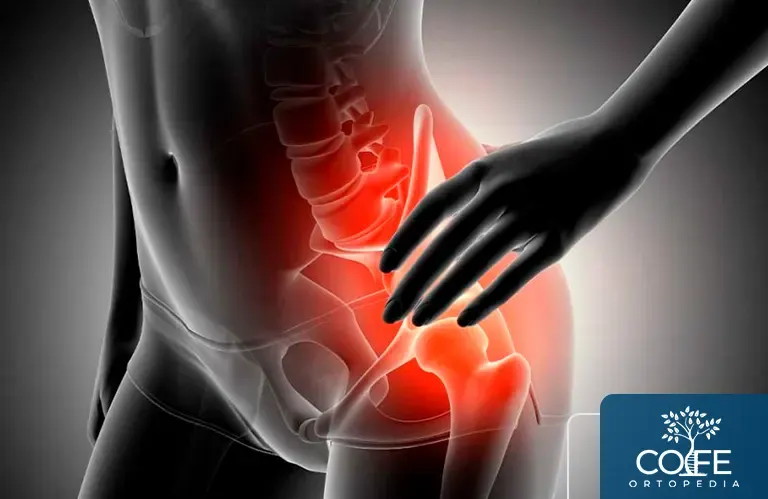 Artrose do quadril: sintomas, causas e opções de tratamento